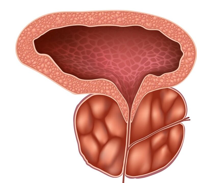 Próstata inflamada que Prostaline puede manejar