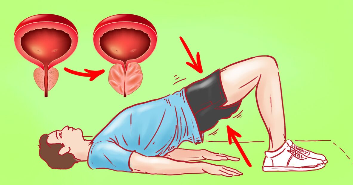 ejercicios gimnásticos para la prostatitis